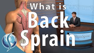 What is a Back Sprain [upl. by Henrion]