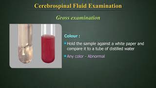 Cerebrospinal Fluid Examination CSF [upl. by Enelam]