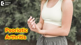 Psoriatic Arthritis Types Symptoms Diagnosis amp Treatment  Dr Chaithanya K S  Doctors Circle [upl. by Brandon]