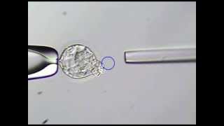 embryology part 1 formation of germ layer [upl. by Ived]