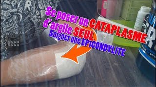 CATAPLASME dARGILE SEUL  Soigner une EPICONDYLITE [upl. by Myrtle]