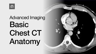 What to Expect From a PETCT Exam [upl. by Ggerc198]