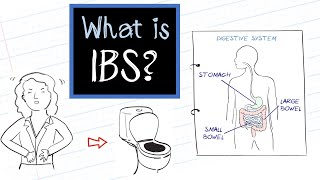 Do I have IBS   Symptoms amp Diagnosis  Irritable Bowel Syndrome [upl. by Guyon]