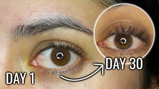 CASTOR OIL FOR EYELASH GROWTH  30 DAY BEFORE AND AFTER RESULTS [upl. by Beverle]