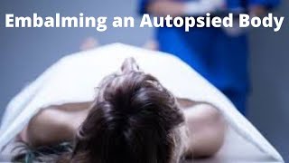 Embalming an autopsied body [upl. by Thier]