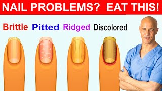 NAIL PROBLEMS  EAT THIS  Dr Mandell [upl. by Auqenehs239]