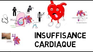 Santé  Crise cardiaque  les idées reçues [upl. by Lertnek]