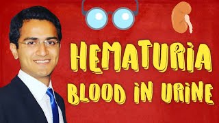 Hematuria Causes amp Diagnostic Workup of Blood in Urine [upl. by Iinde634]