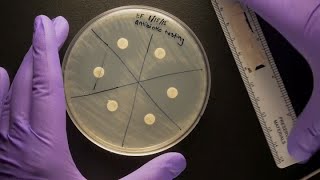 ID Laboratory Videos Antibiotic susceptibility testing [upl. by Neema]