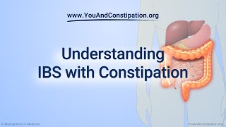 Understanding IBS with Constipation [upl. by Ahael978]