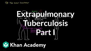 Extrapulmonary TB part 1  Infectious diseases  NCLEXRN  Khan Academy [upl. by Art]