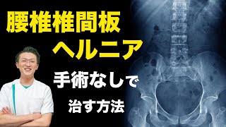 腰椎椎間板ヘルニア手術なしで治す方法 [upl. by Perry]