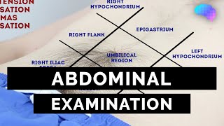 Abdominal Examination  OSCE Guide Latest  UKMLA  CPSA  PLAB 2 [upl. by Adrahc]