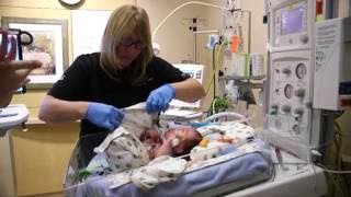 Causes Behind Premature Births [upl. by Asle]