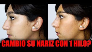 Hilos tensores nariz 🔥  Rinomodelación con hilos  Todo sobre la RINOPLASTIA CON HILOS 😱 [upl. by Assirok339]