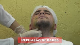 Depilando a BARBA com Cera Quente wax [upl. by Nivlam771]