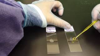 Microbiology the Catalase test [upl. by Blayze]