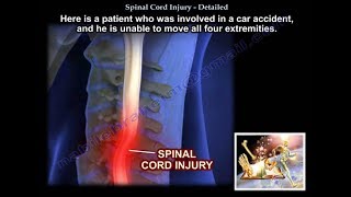 Spinal Cord Injury Detailed  Everything You Need To Know  Dr Nabil Ebraheim [upl. by Wallie434]