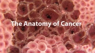 What Is Cancer What Causes Cancer amp How Is It Treated [upl. by Nanor597]