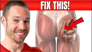 How To Fix Piriformis Syndrome Causes Symptoms Treatment [upl. by Udell371]