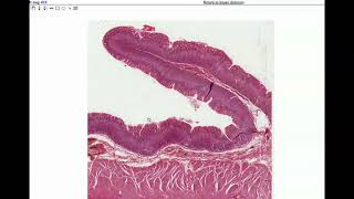 Anatomy  Histology of the Stomach amp Small Intestine [upl. by Antonie]