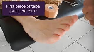 How To Hold A Curly Pinky Toe Straight With Tape [upl. by Ydnir907]