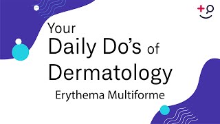 Erythema Multiforme  Daily Dos of Dermatology [upl. by Price]