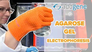 Agarose Gel Electrophoresis [upl. by Nnairda]