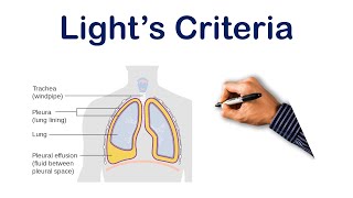 Pleural Effusion Lights Criteria  USMLE STEP COMLEX NCLEX [upl. by Oam157]