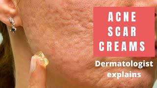 Acne Scar Creams  Dermatologist Reviews [upl. by Dreyer]