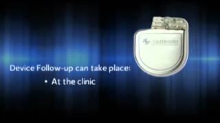 What is an Implantable Cardioverter Defibrillator ICD [upl. by Dnana]