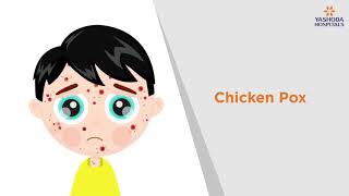 Chicken Pox Symptoms Causes Prevention and Treatment  Yashoda Hospitals [upl. by Antipus]