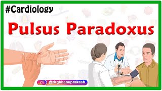 Pulsus Paradoxus  Examination of the arterial pulse  Cardiology USMLE [upl. by Covell]