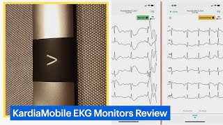 KardiaMobile Personal EKG Monitors Review [upl. by Oderfigis]