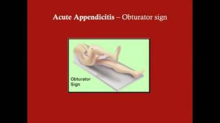 Acute Appendicitis  CRASH Medical Review Series [upl. by Lilla373]