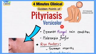 Pityriasis Versicolor Explained Like Water  Symptoms Pathogenesis Treatment  4 Minutes Clinical [upl. by Engle]