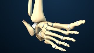 Ankle Fracture Surgery [upl. by Olia]