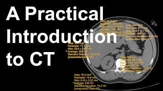 A Practical Introduction to CT [upl. by Nnylg]