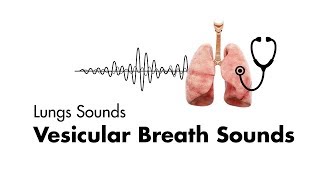 Vesicular Breath Sounds  Normal Lung Sounds  MEDZCOOL [upl. by Spatz]