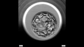 EmbryoScope Embryo Development  Blastocyst [upl. by Aztirak]