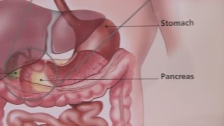 Irritable Bowel Syndrome Treatments  GI Society [upl. by Pinkerton455]