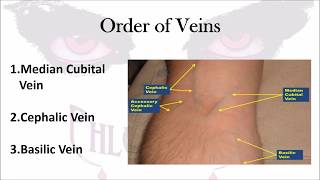 Phlebotomy The Order of Veins [upl. by Dorkus]