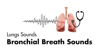 Common Intubation Scenarios Bronchiolitis by T Mancuso  OPENPediatrics [upl. by Neeliak]