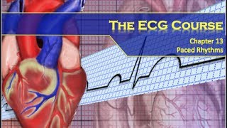 The ECG Course  Paced Rhythms [upl. by Dutch]