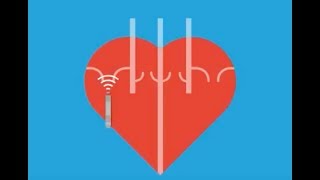 ECG Heart Rate Calculation  The Six Second Method [upl. by Aniar]