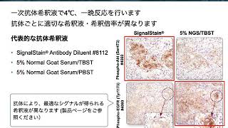 免疫組織化学染色 IHC の基礎：第3回 免疫染色 [upl. by Auqinahs]