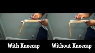 How To Fix Pain In The Front Of The Knee Runners knee [upl. by Neelrak36]