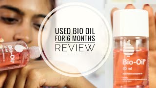 Bio Oil Review  Does Bio Oil Work on Stretch Marks amp Scars  SuperWowStyle [upl. by Fillbert391]