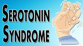 Managing Serotonin Syndrome [upl. by Elad]