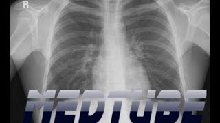 How to read a Chest Radiograph easily [upl. by Anatole596]